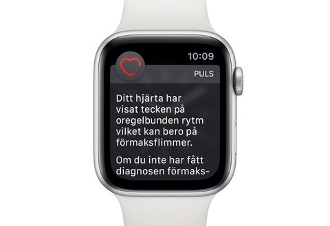 Apple Watch tar EKG direkt på din arm